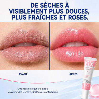 LÈVRES ROSES Bellevie™ - Masque Réparateur 5X Niacinamide Belle Vie Market Soulagement du mal dos en 5 minutes